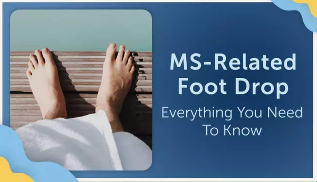 Featured image for “Foot Drop: Everything You Need To Know”