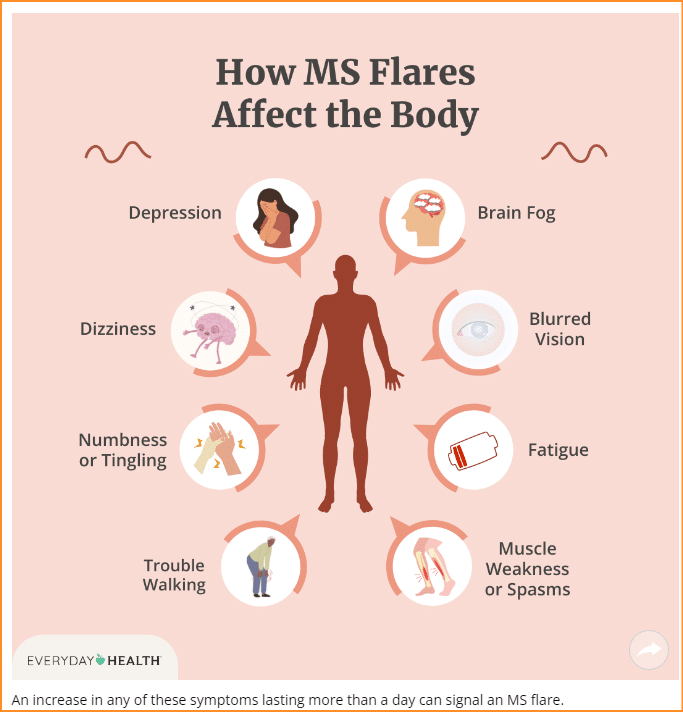 Featured image for “How to Spot the Signs of an MS Flare”