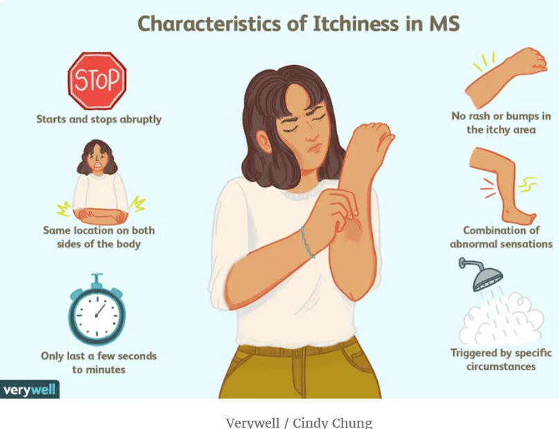 Featured image for “Itchiness as a Symptom of Multiple Sclerosis”