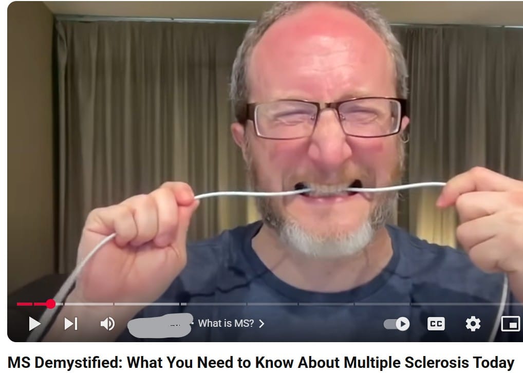 Featured image for “MS Demystified: What You Need to Know About Multiple Sclerosis Today –”