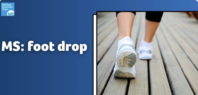 Featured image for “Foot Drop or Dropped Foot”