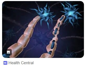 Featured image for “Two compounds with potential for myelin repair in MS identified”